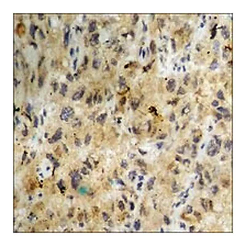 Merck ANTI-PHOSPHO-CASEIN KINASE II ALPHA (PTY