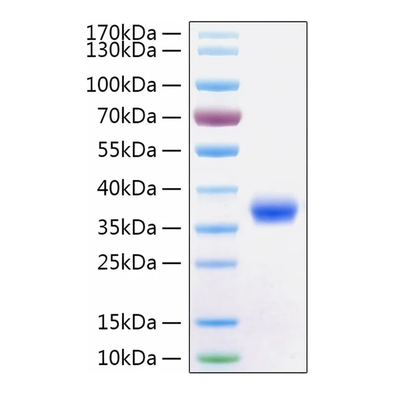 Merck RECOMBINANT 2019-NCOV SPIKE RBD PROTEIN&