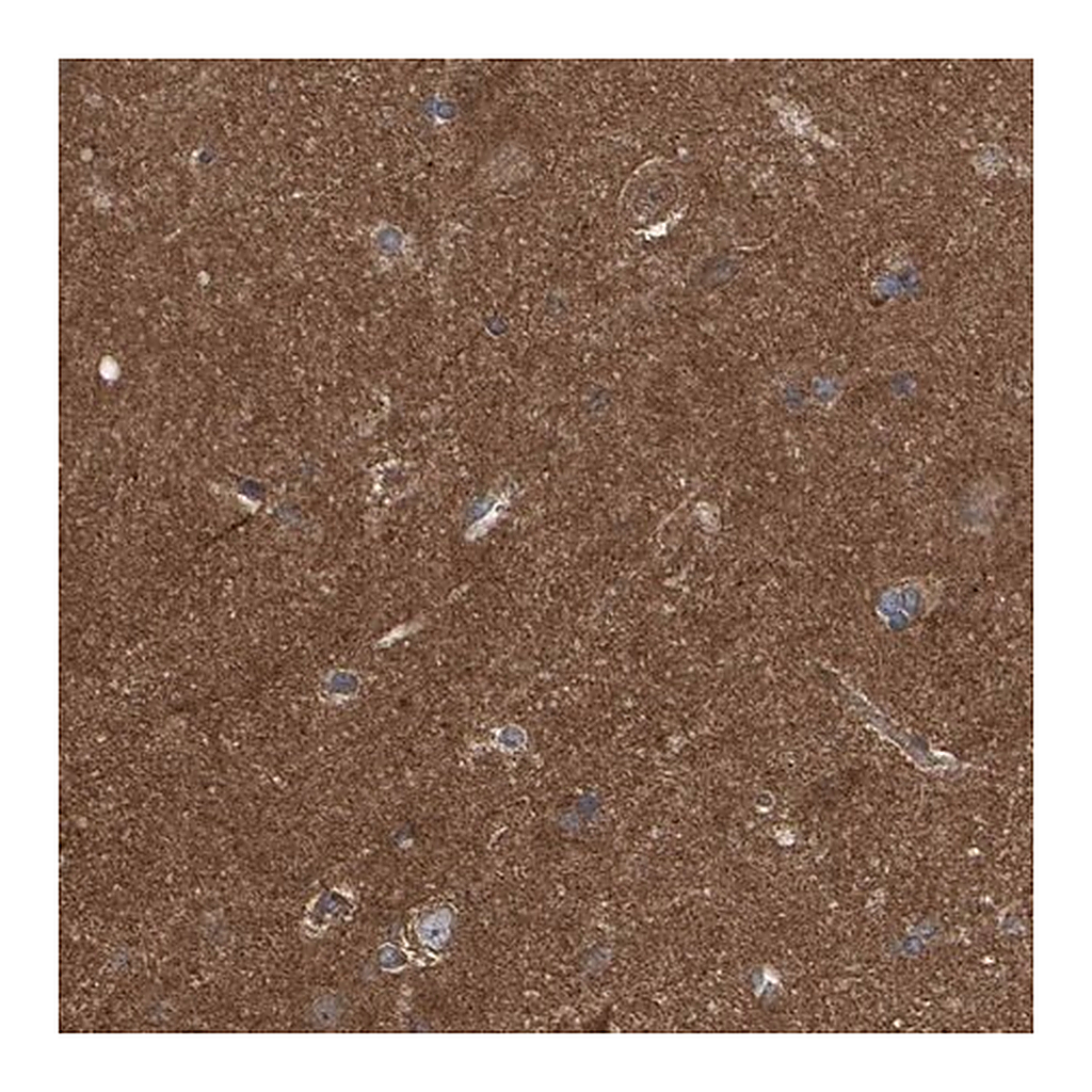 Merck Anti-LRSAM1 antibody produced in rabbit