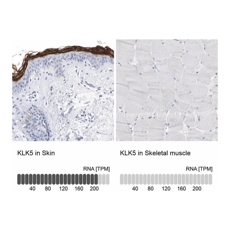 Merck Anti-KLK5 antibody produced in rabbit