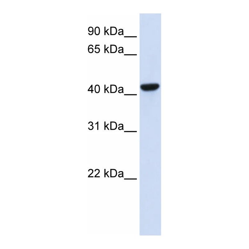 Merck Anti-CTH antibody produced in rabbit