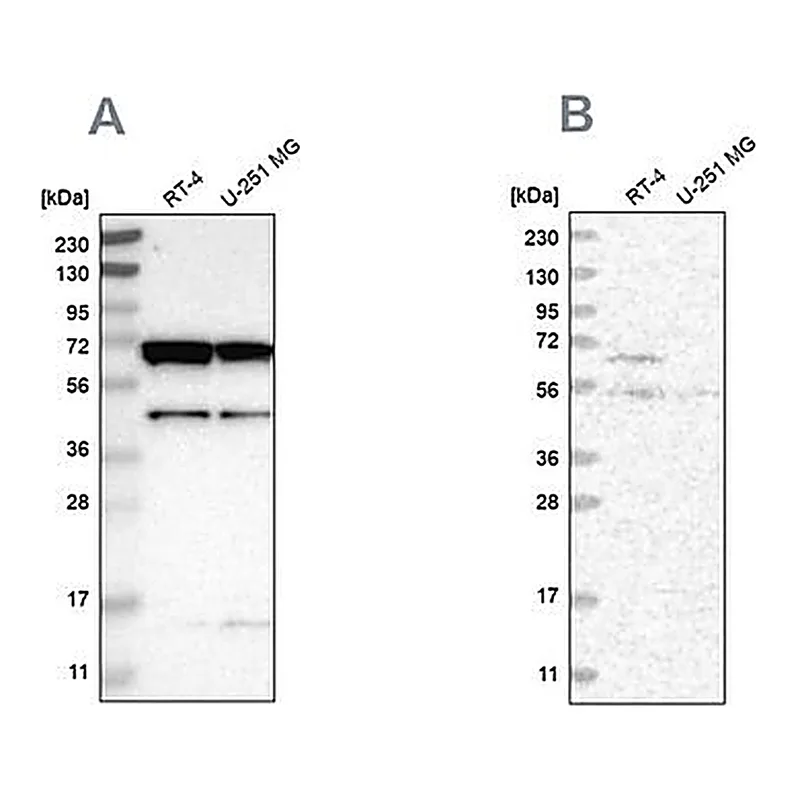 Merck Anti-CROT antibody produced in rabbit