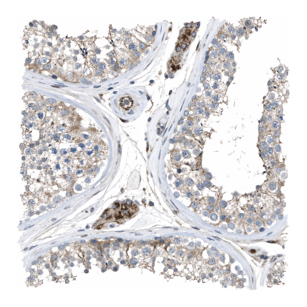 Merck Anti-CLCN2 antibody produced in rabbit