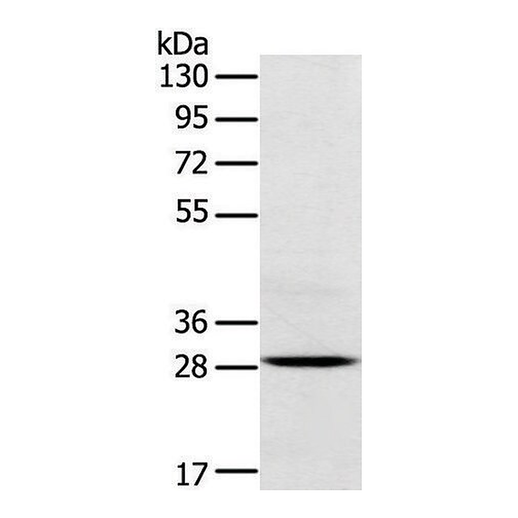 Merck Anti-TREM2