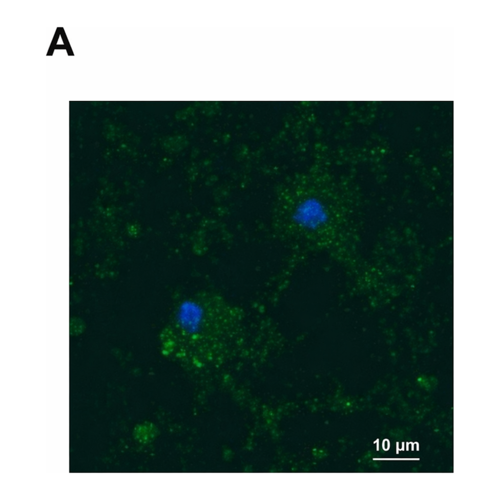 Merck Anti-YB-1 (C-terminal) antibody produced in rabbit