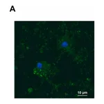 Merck Anti-YB-1 (C-terminal) antibody produced in rabbit