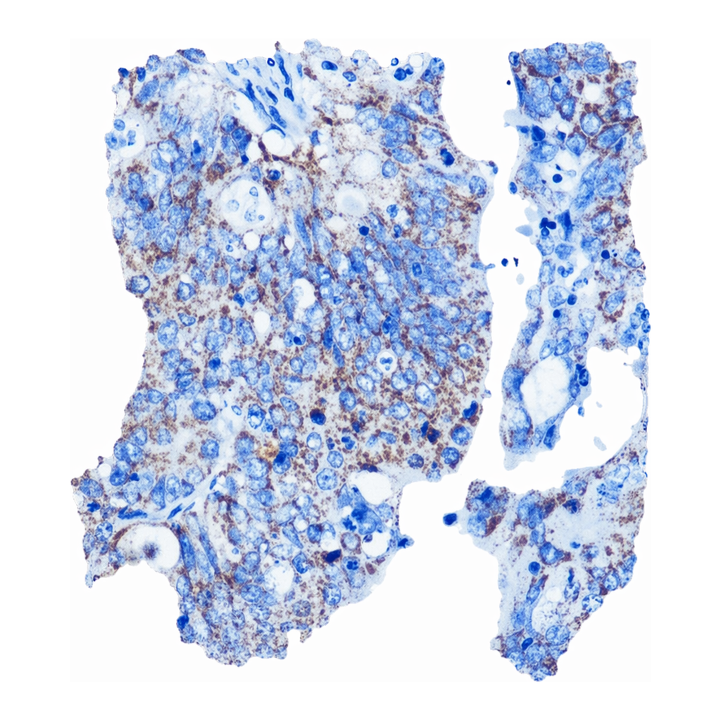 Merck Anti-MMP13 antibody produced in rabbit