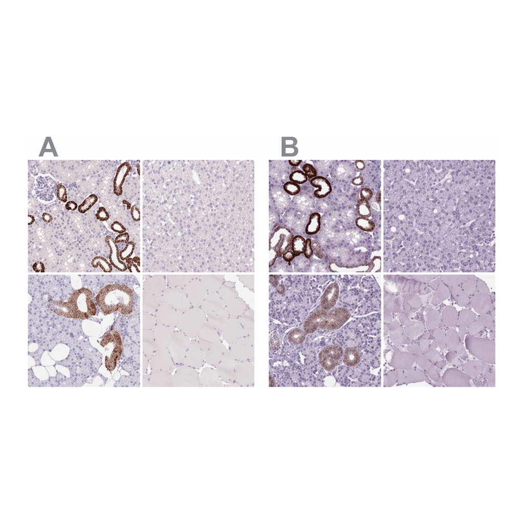 Merck Anti-BSND antibody produced in rabbit