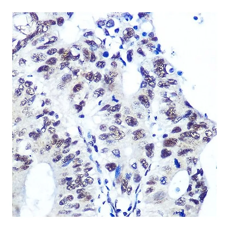 Merck Anti-Ku70 antibody produced in rabbit
