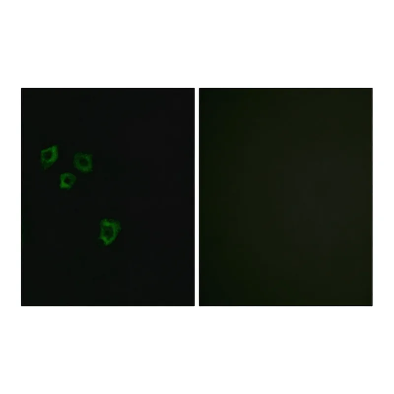Merck Anti-MUC16 antibody produced in rabbit