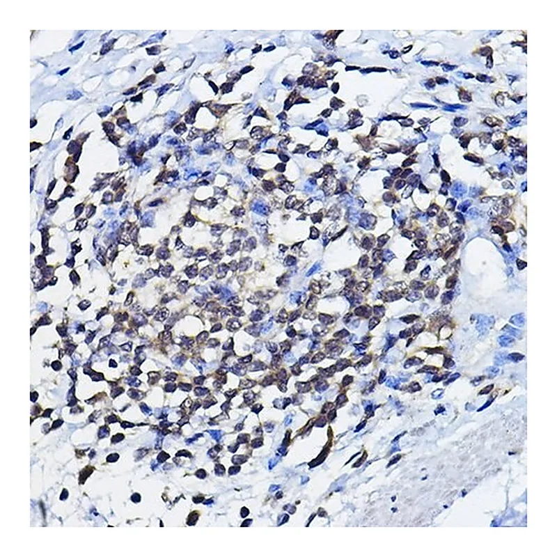 Merck Anti-TP73 antibody produced in rabbit