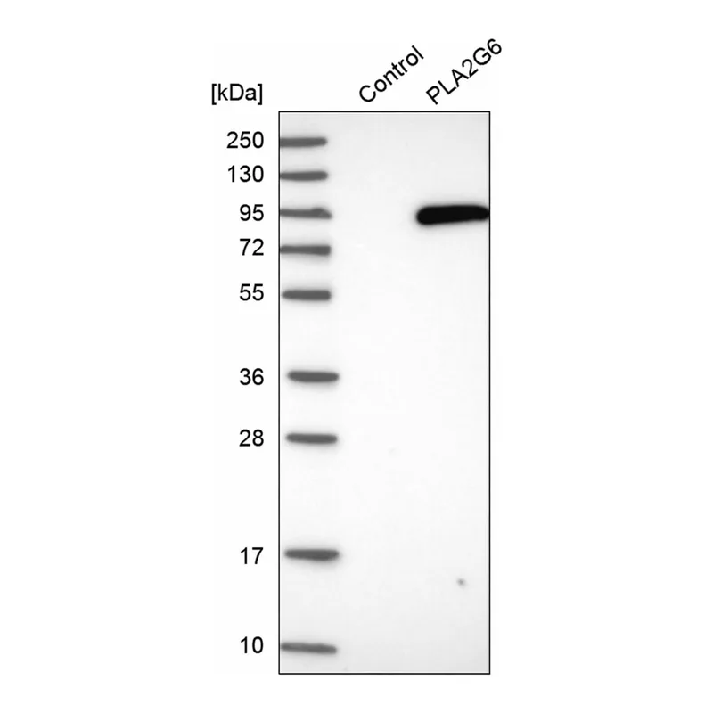 Merck Anti-PLA2G6 antibody produced in rabbit