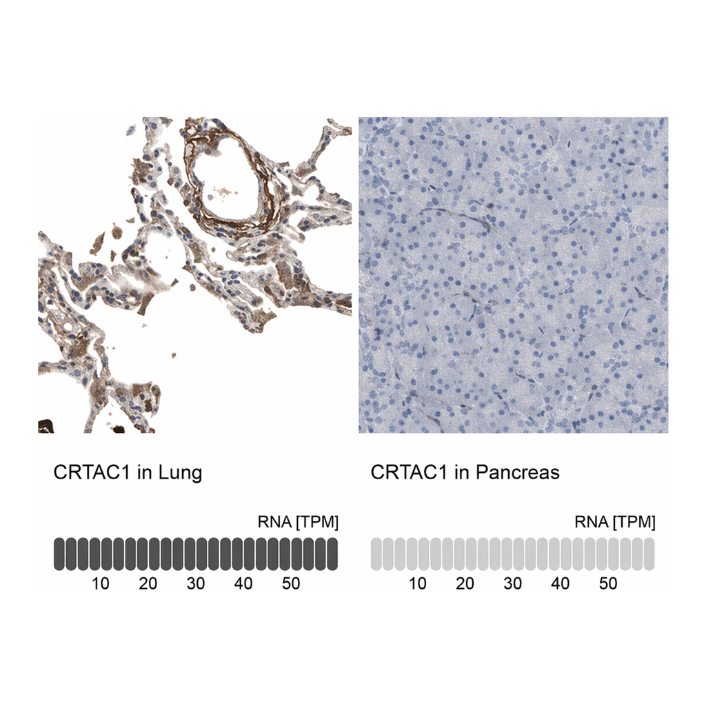 Merck Anti-CRTAC1 antibody produced in rabbit