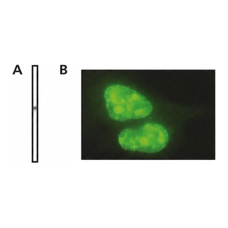 Merck Monoclonal Anti-MTA2 antibody produced in mouse