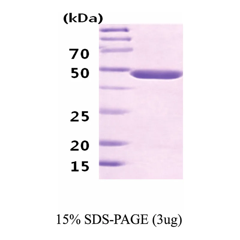 Merck Neuron-Specific Enolase human