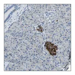 Merck ANTI-PRSS57