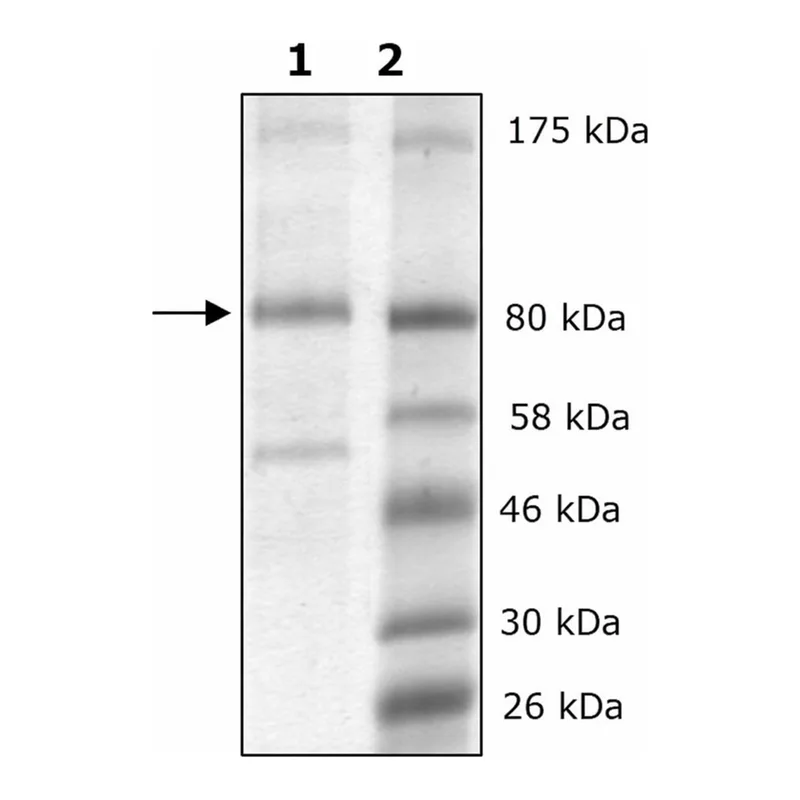 Merck LOXL2 human
