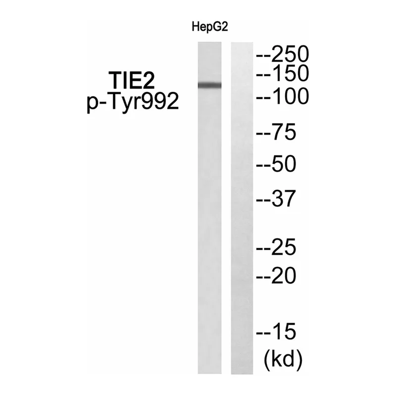 Merck Anti-phospho-TIE2 (pTyr992) antibody produced in rabbit