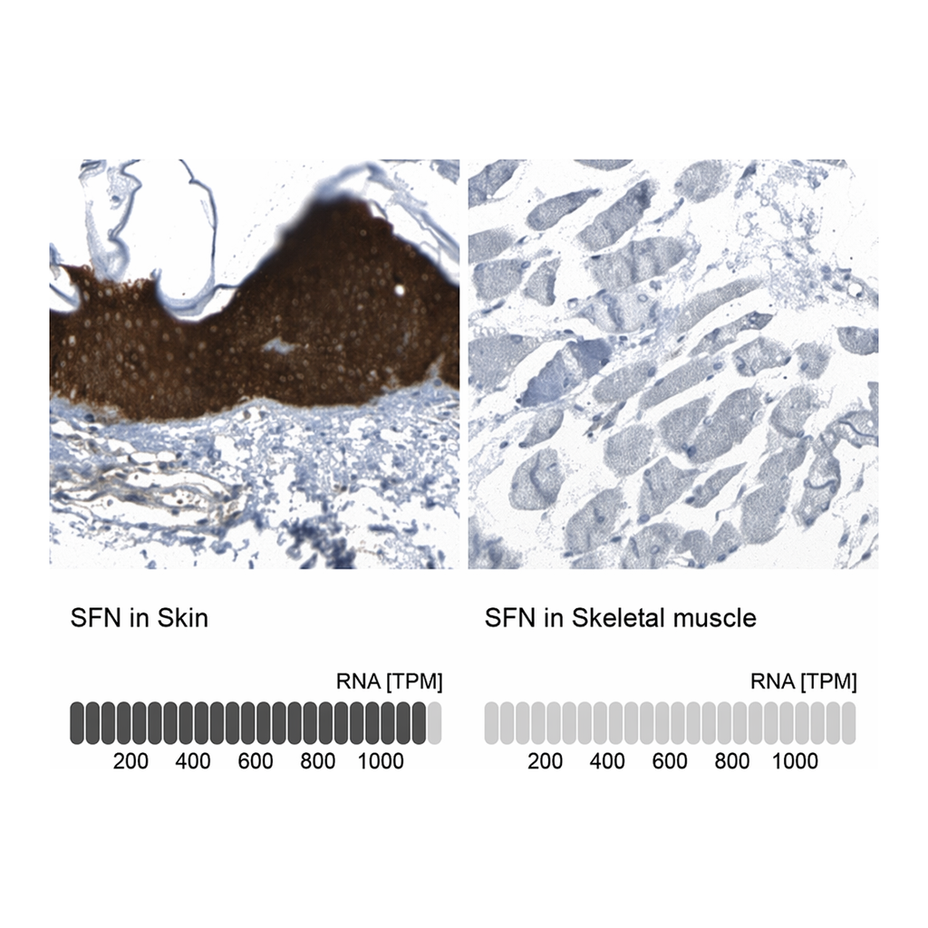 Merck Anti-SFN antibody produced in rabbit