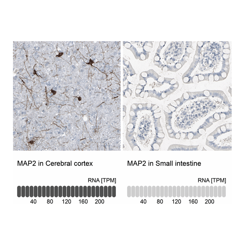 Merck Anti-MAP2 antibody produced in rabbit