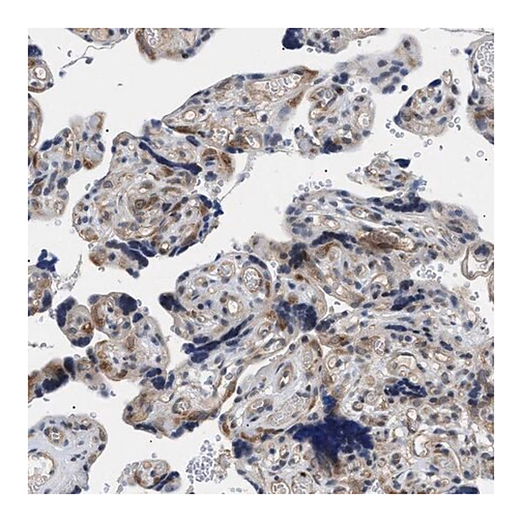 Merck Anti-KIAA0355 antibody produced in rabbit