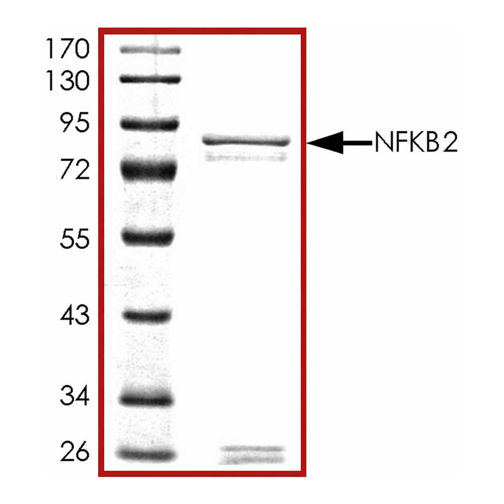 Merck NFKB2 (1-454), GST tagged human
