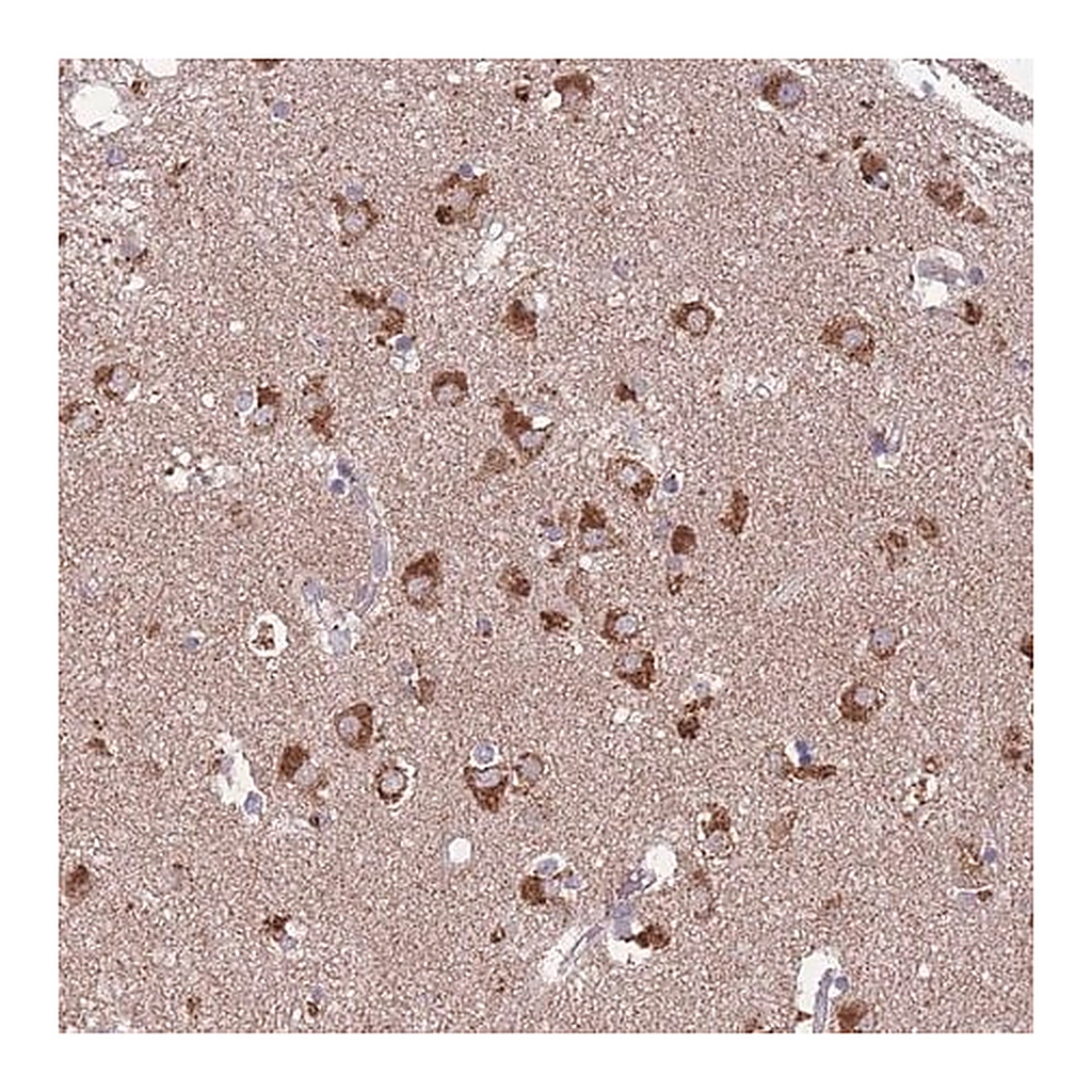 Merck Anti-STIM2 antibody produced in rabbit