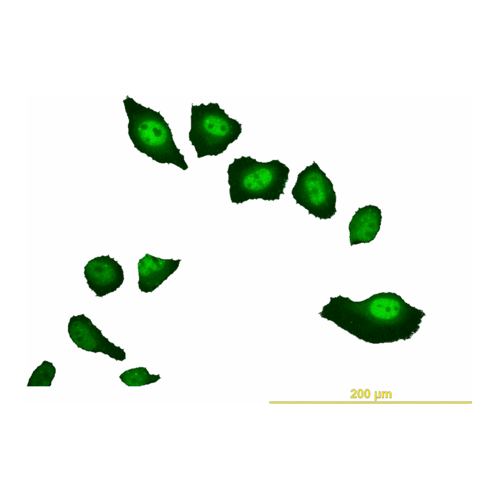Merck Monoclonal Anti-VRK2 antibody produced in mouse