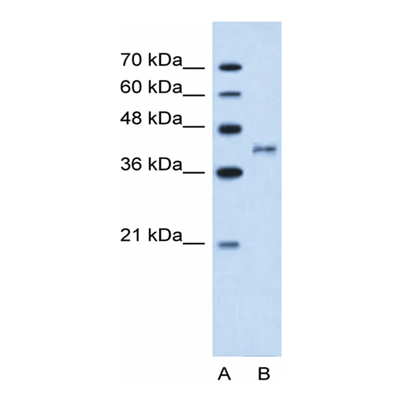 Merck Anti-BDKRB2 antibody produced in rabbit