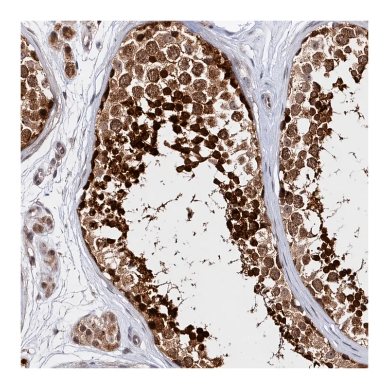 Merck Anti-KATNA1 antibody produced in rabbit