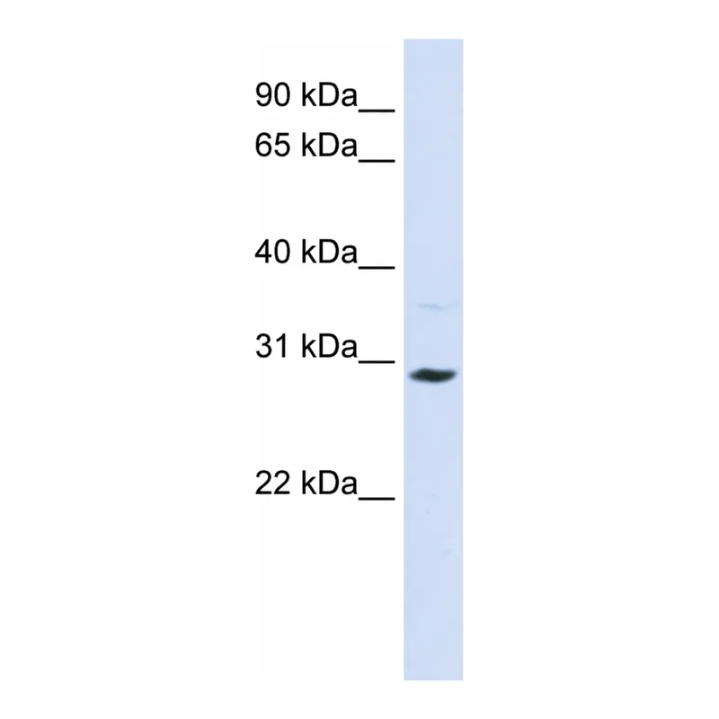 Merck Anti-SLC25A20 antibody produced in rabbit