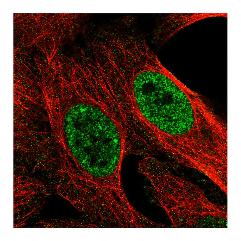 Atlas Antibodies Anti-MED22 Antibody