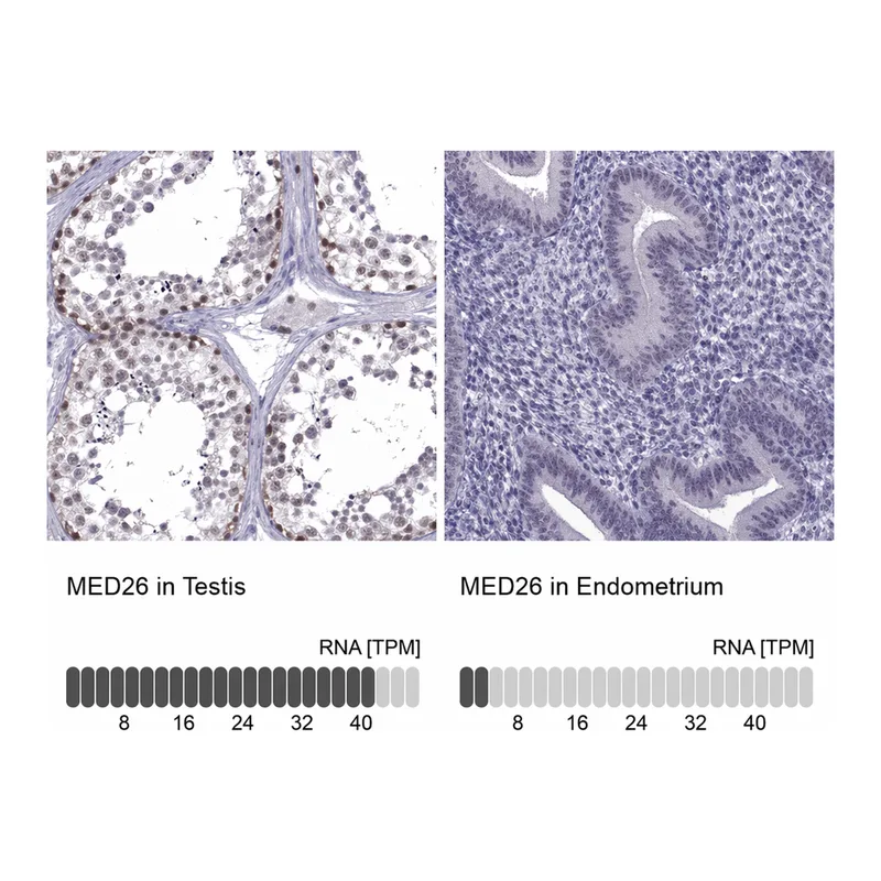 Atlas Antibodies Anti-MED26 Antibody