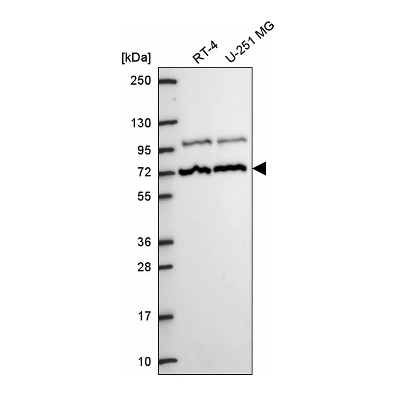 Atlas Antibodies Anti-MED25 Antibody