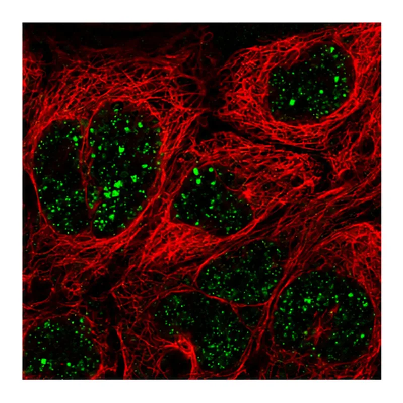 Atlas Antibodies Anti-MED7 Antibody