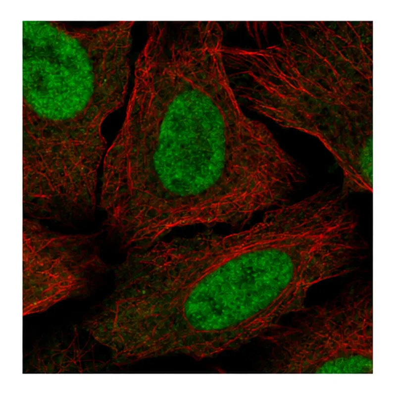 Atlas Antibodies Anti-MED30 Antibody