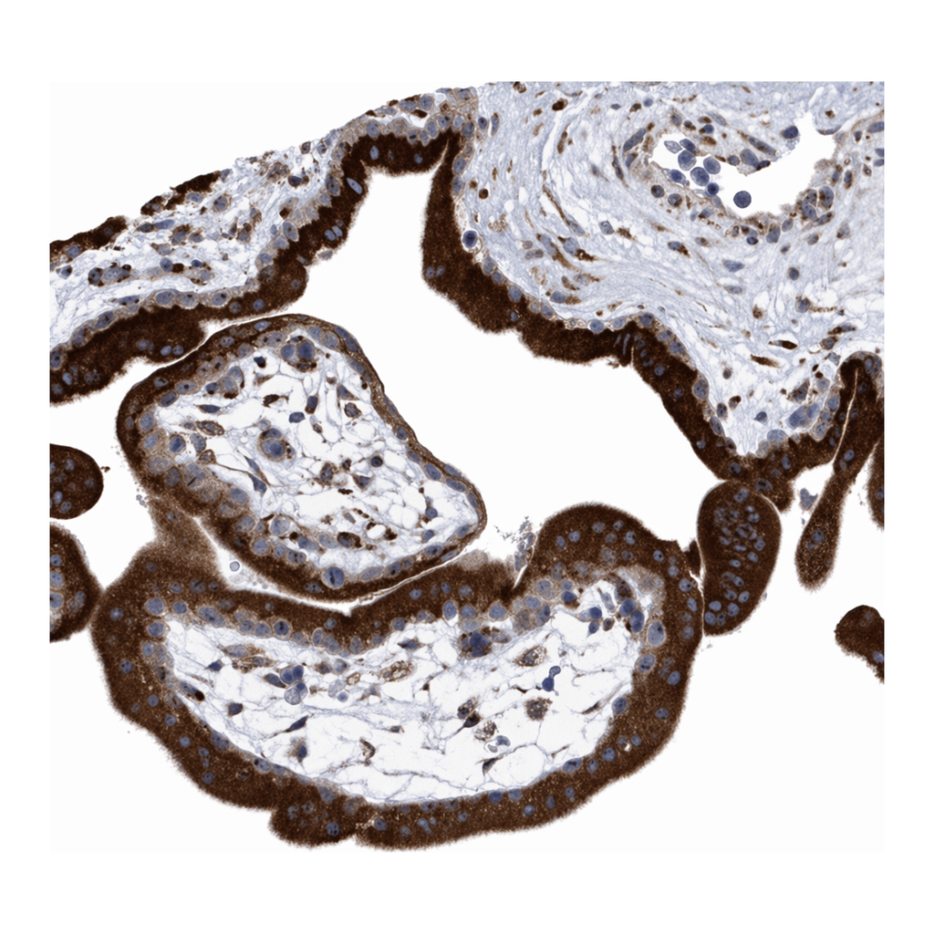 Atlas Antibodies Anti-MED31 Antibody