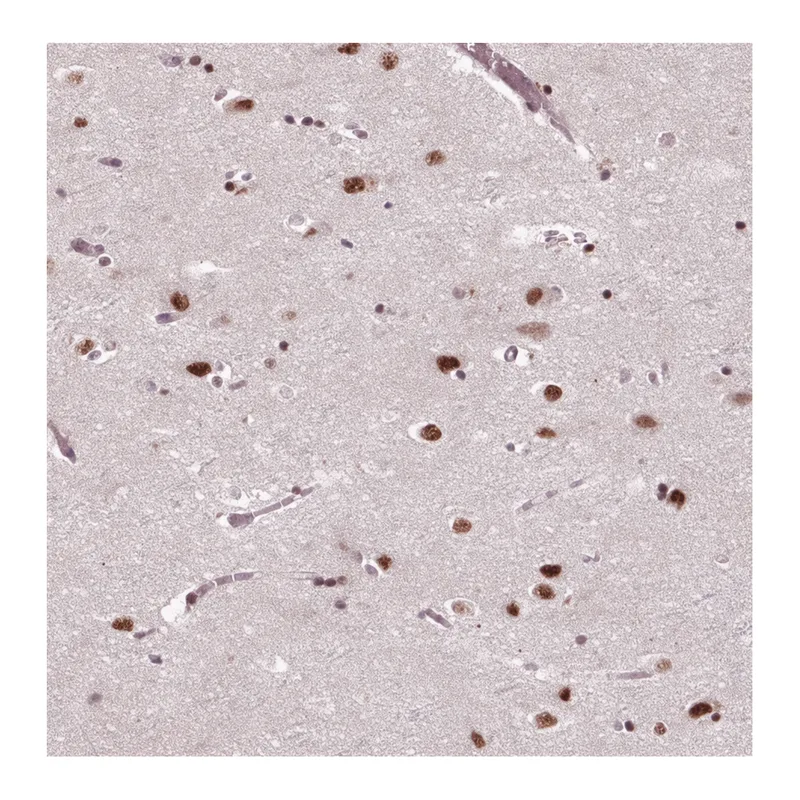 Atlas Antibodies Anti-MED6 Antibody
