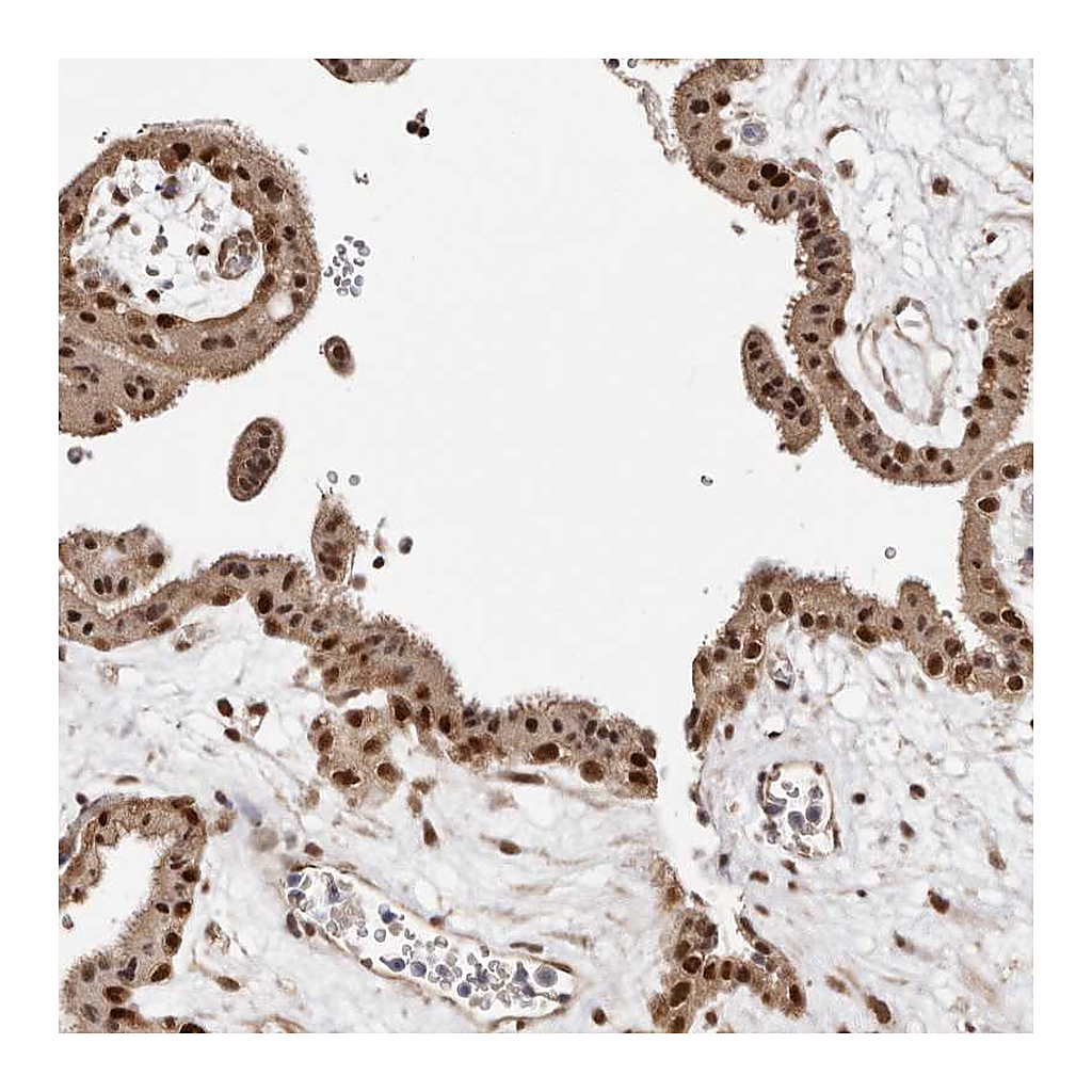 Atlas Antibodies Anti-MED8 Antibody