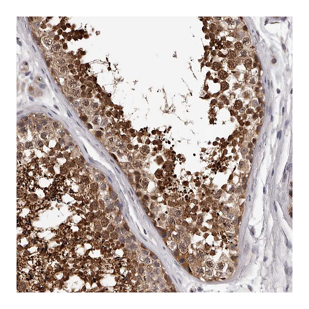 Atlas Antibodies Anti-MED8 Antibody