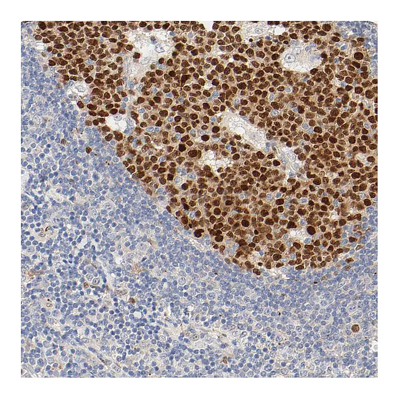 Atlas Antibodies Anti-MEF2B Antibody