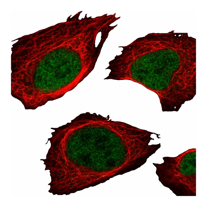 Atlas Antibodies Anti-MEF2A Antibody