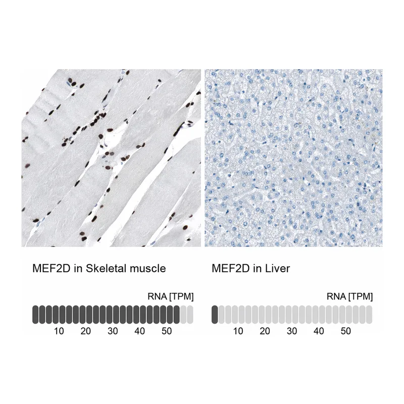 Atlas Antibodies Anti-MEF2D Antibody