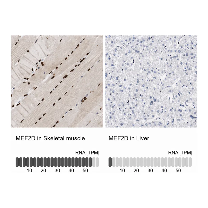 Atlas Antibodies Anti-MEF2D Antibody