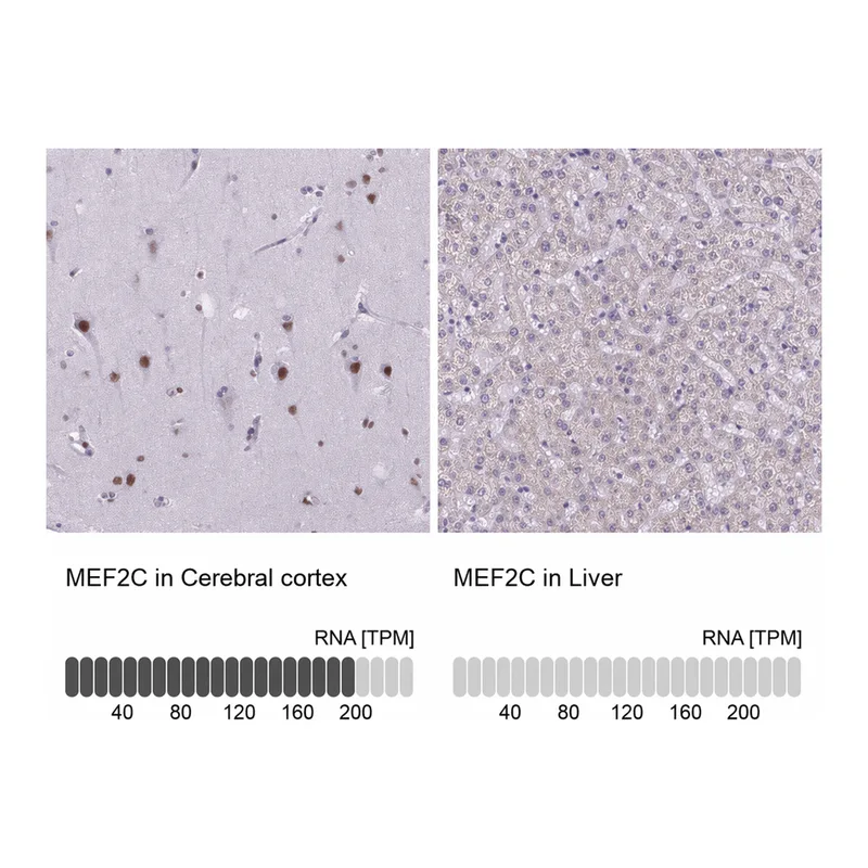 Atlas Antibodies Anti-MEF2C Antibody