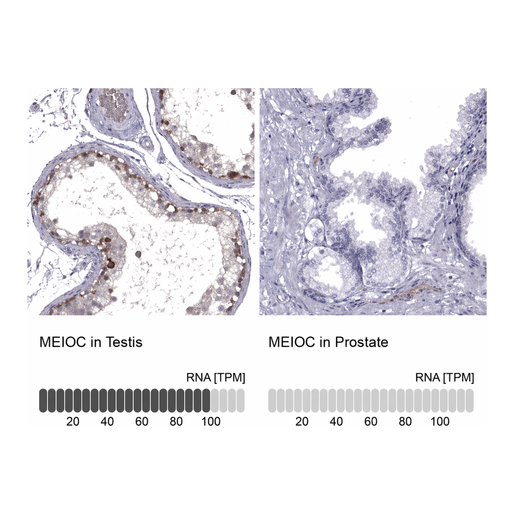 Atlas Antibodies Anti-MEIOC Antibody