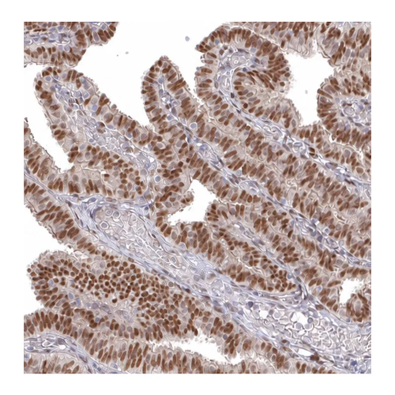 Atlas Antibodies Anti-MEIS1 Antibody