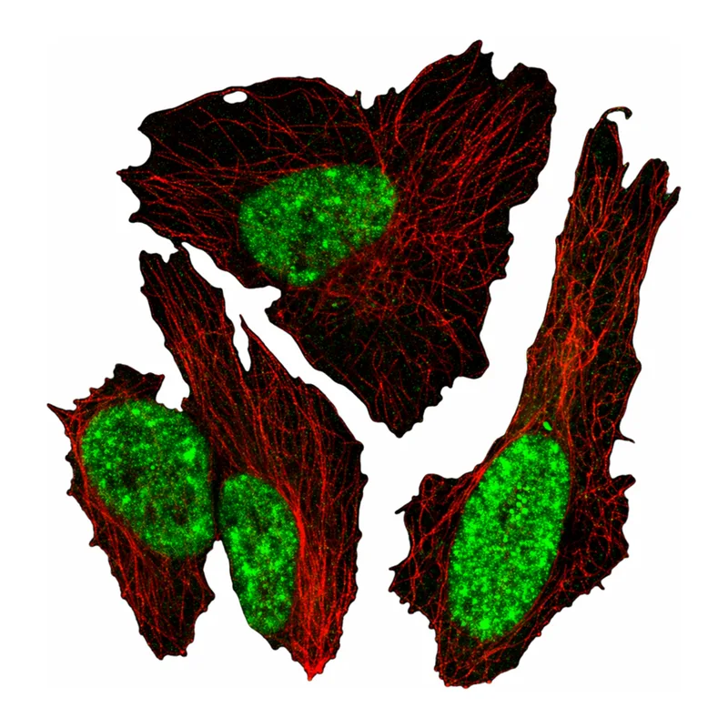 Atlas Antibodies Anti-MEIS1 Antibody