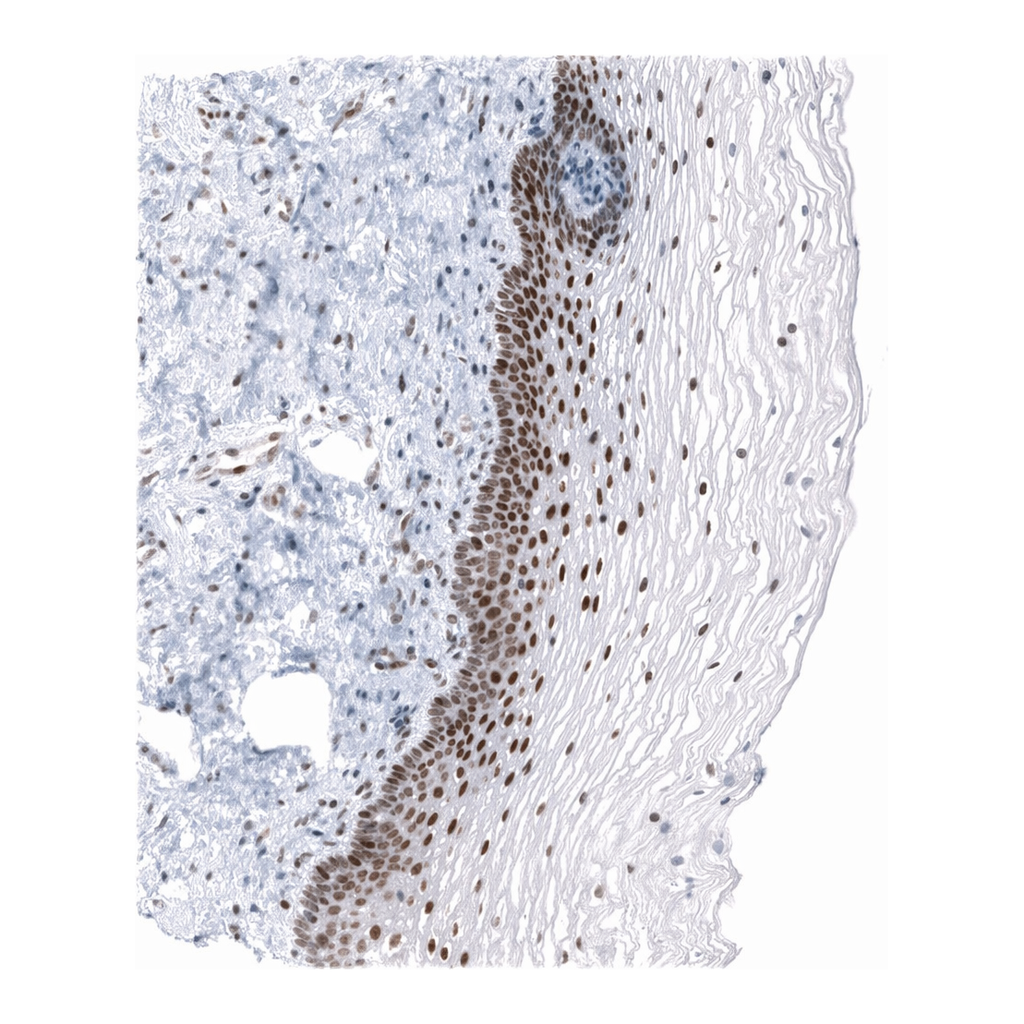 Atlas Antibodies Anti-MEIS3 Antibody