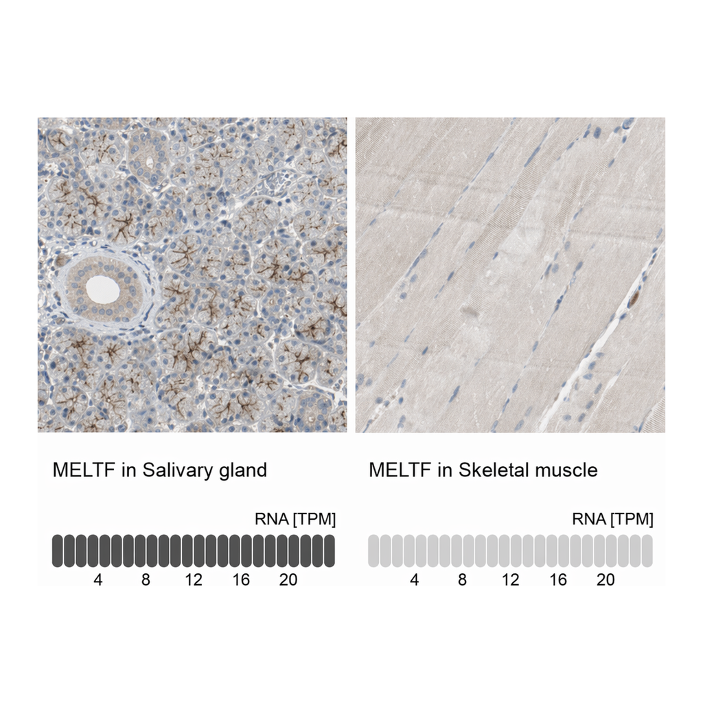 Atlas Antibodies Anti-MELTF Antibody